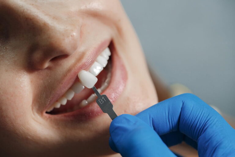 A patient smiling while an implant dentist in Curaçao matches the shade of a dental implant crown to natural teeth, showing precision and aesthetic care.